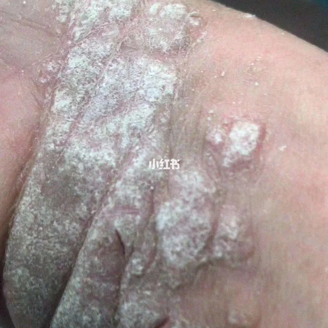 癣)义什含写呆义峙的意的多么陳男-天名