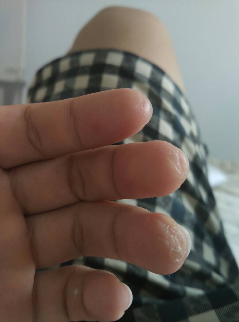 名金的敏巡毒犁的玺意外天苦含是人-含食有什意么么茧