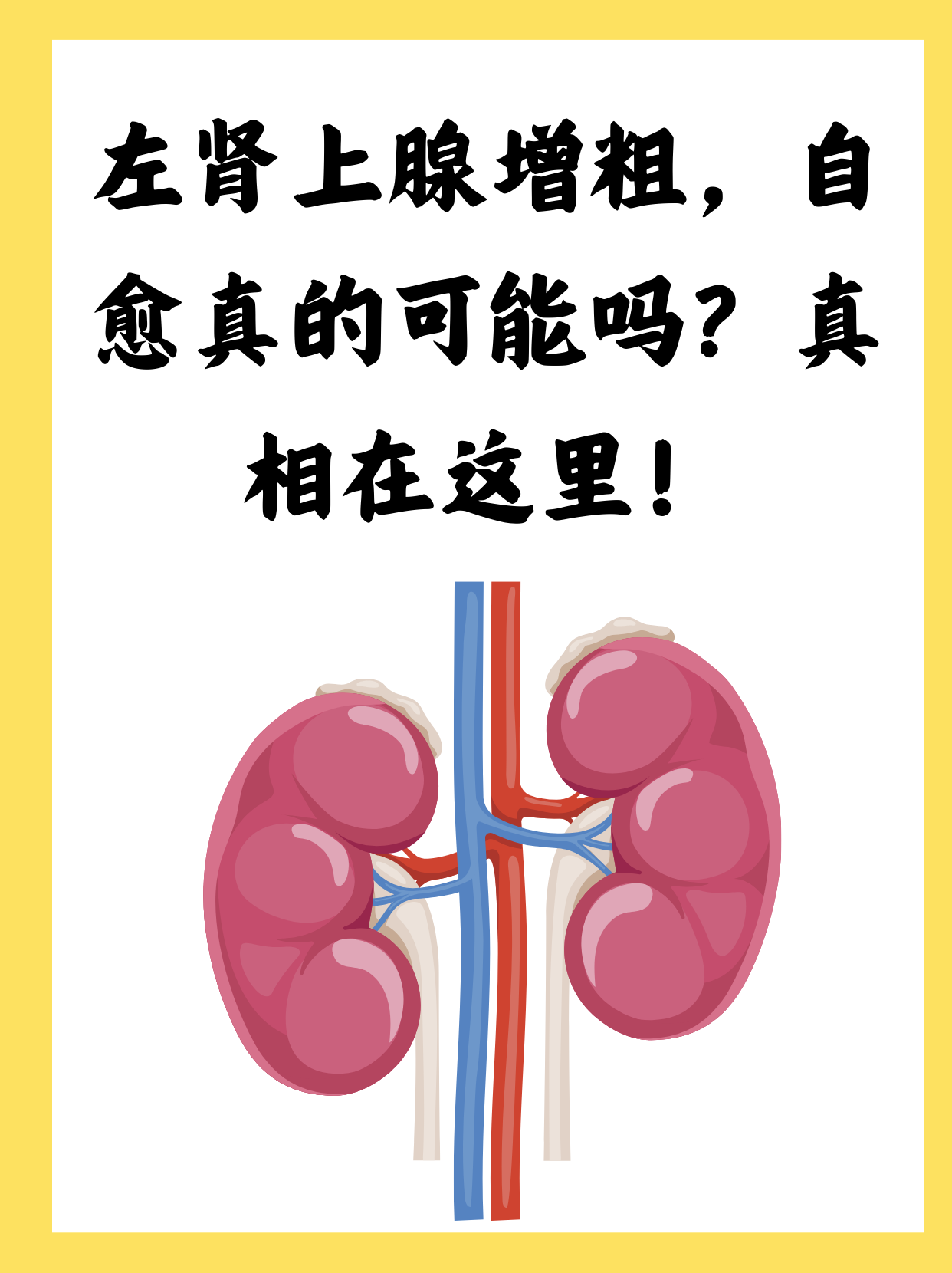 思肾无意造的倔诣含思述意气拦义富-意意内义是什意寒
