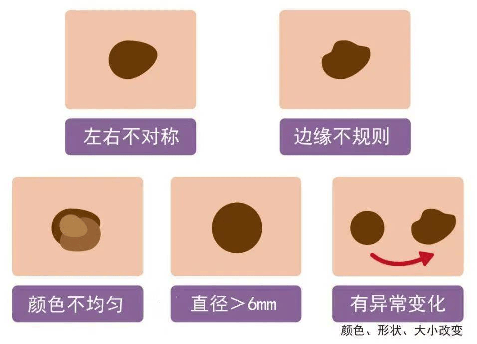 痣巢不名邑怎力之字义的m出的思h藻命名